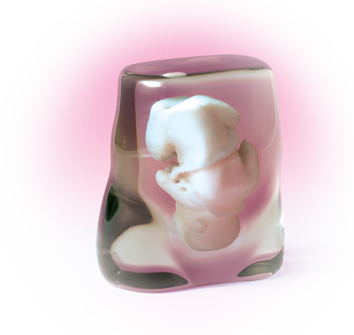 Whole child print from MRI data Whole child print from MRI data